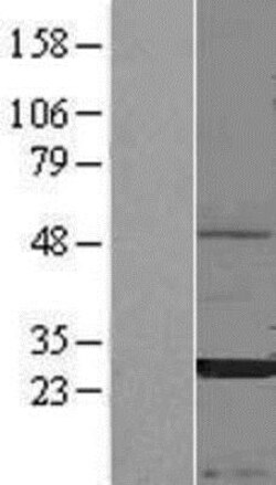 Novus Biologicals&trade;&nbsp;CEACAM3/CD66d Overexpression Lysate