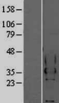 Novus Biologicals&trade;&nbsp;CEACAM4 Overexpression Lysate