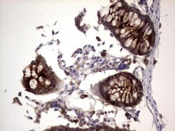 CEACAM5/CD66e Antibody (OTI3D8), Novus Biologicals 0.1mL; Unlabeled:Antibodies,