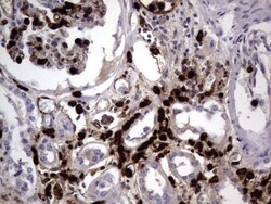 CEACAM5/CD66e Antibody (OTI3D8), Novus Biologicals 0.1mL; Unlabeled:Antibodies,