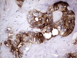 CEACAM5/CD66e Antibody (OTI3D8), Novus Biologicals 0.1mL; Unlabeled:Antibodies,