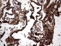 CEACAM5/CD66e Antibody (OTI3D8), Novus Biologicals 0.1mL; Unlabeled:Antibodies,