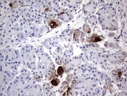 CEACAM5/CD66e Antibody (OTI3D8), Novus Biologicals 0.1mL; Unlabeled:Antibodies,