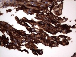 CEACAM5/CD66e Antibody (OTI3D8), Novus Biologicals 0.1mL; Unlabeled:Antibodies,