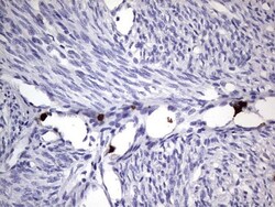 CEACAM5/CD66e Antibody (OTI3D8), Novus Biologicals 0.1mL; Unlabeled:Antibodies,