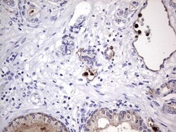 CEACAM5/CD66e Antibody (OTI3D8), Novus Biologicals 0.1mL; Unlabeled:Antibodies,