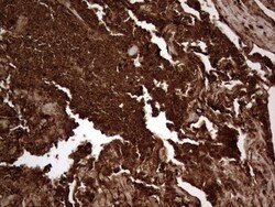 CEACAM5/CD66e Antibody (OTI3D8), Novus Biologicals 0.1mL; Unlabeled:Antibodies,