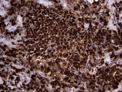 CEACAM5/CD66e Antibody (OTI3D8), Novus Biologicals 0.1mL; Unlabeled:Antibodies,