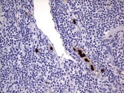 CEACAM5/CD66e Antibody (OTI3D8), Novus Biologicals 0.1mL; Unlabeled:Antibodies,