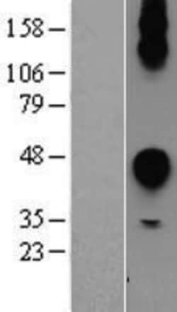 Novus Biologicals&trade;&nbsp;CEACAM7 Overexpression Lysate