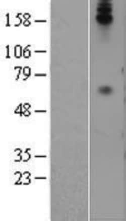 Novus Biologicals&trade;&nbsp;CEACAM8/CD66b Overexpression Lysate