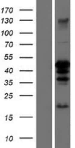 Novus Biologicals&trade;&nbsp;CEBP alpha Overexpression Lysate