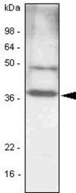 CEBP Beta Antibody (47A1) - BSA Free, Novus Biologicals 0.1mL; Unlabeled:Antibodies,