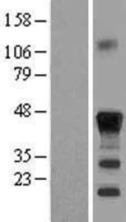 Novus Biologicals&trade;&nbsp;CEBP Beta Overexpression Lysate