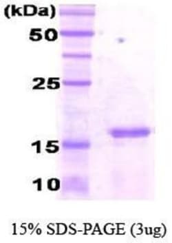 Novus Biologicals&trade;&nbsp;Recombinant Human CEBP gamma His Protein