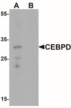 CEBP Delta Antibody - BSA Free, Novus Biologicals 0.025 mg, Unlabeled:Antibodies,