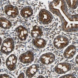 CECR5 Antibody, Novus Biologicals 25 &mu;L, Unconjugated:Antibodies, Polyclonal