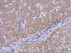 CEECAM1 Antibody, Novus Biologicals 0.1mL; Unlabeled:Antibodies, Polyclonal