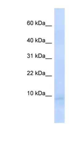 CEND1 Antibody, Novus Biologicals 100&mu;L; Unlabeled:Antibodies, Polyclonal