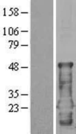 Novus Biologicals&trade;&nbsp;CEND1 Overexpression Lysate