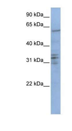 CENPB Antibody, Novus Biologicals 100&mu;L; Unlabeled:Antibodies, Polyclonal