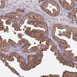 CENPBD1 Antibody, Novus Biologicals:Antibodies:Primary Antibodies