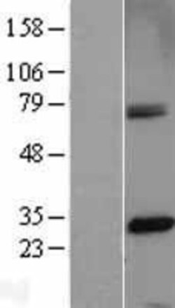 Novus Biologicals&trade;&nbsp;CENPH Overexpression Lysate