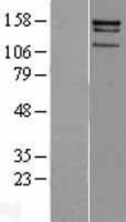 Novus Biologicals&trade;&nbsp;CENPJ Overexpression Lysate