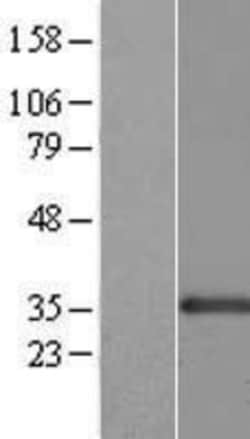 Novus Biologicals&trade;&nbsp;CENPK Overexpression Lysate