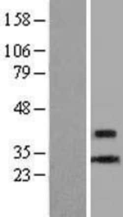 Novus Biologicals&trade;&nbsp;CENPL Overexpression Lysate