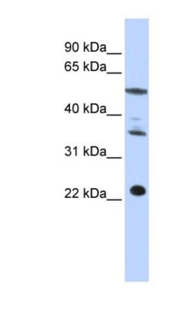 CENPM Antibody, Novus Biologicals:Antibodies:Primary Antibodies