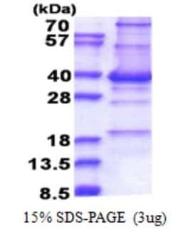 Novus Biologicals&trade;&nbsp;Recombinant Human CENPP His Protein