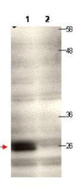 CENPQ Antibody, Novus Biologicals 0.1 mg | Buy Online | Novus Biologicals | Fisher Scientific