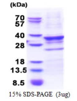 Novus Biologicals&trade;&nbsp;Recombinant Human CENPQ His Protein