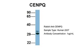 CENPQ Antibody, Novus Biologicals 100&mu;L; Unlabeled:Antibodies, Polyclonal