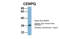 CENPQ Antibody, Novus Biologicals 100&mu;L; Unlabeled:Antibodies, Polyclonal