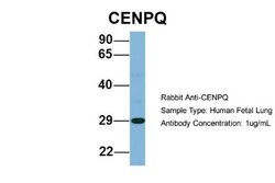 CENPQ Antibody, Novus Biologicals 100&mu;L; Unlabeled:Antibodies, Polyclonal