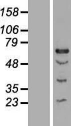 Novus Biologicals&trade;&nbsp;CENPT Overexpression Lysate