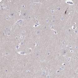 CENPT Antibody, Novus Biologicals 0.1mL; Unlabeled:Antibodies, Polyclonal