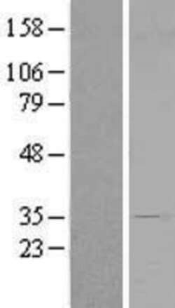 Novus Biologicals&trade;&nbsp;CENPV Overexpression Lysate