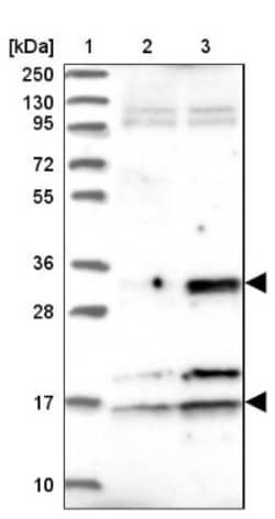 CENPV Antibody, Novus Biologicals 25 &mu;L | Buy Online | Novus Biologicals | Fisher Scientific