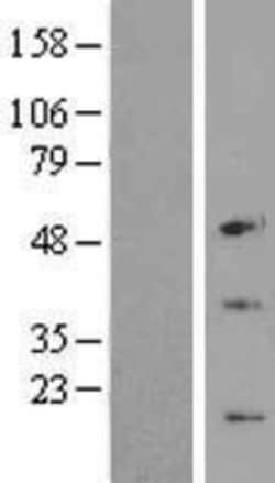 Novus Biologicals&trade;&nbsp;CENPW Overexpression Lysate