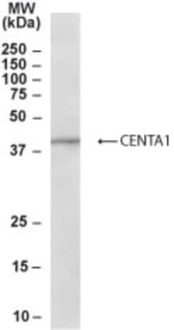 Centaurin alpha 1 Antibody, Novus Biologicals 0.1mg; Unlabeled:Antibodies,