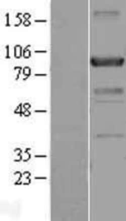 Novus Biologicals&trade;&nbsp;Centaurin beta 2 Overexpression Lysate