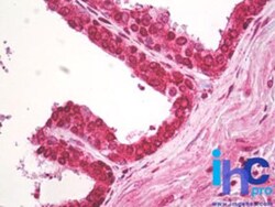 Centaurin beta 2 Antibody, Novus Biologicals 0.1mg; Unlabeled:Antibodies,