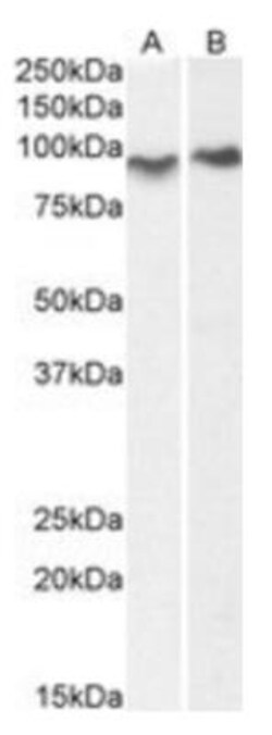 Centaurin beta 2 Antibody, Novus Biologicals 0.1 mg | Buy Online | Novus Biologicals | Fisher Scientific