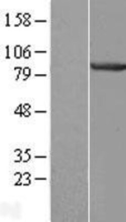 Novus Biologicals&trade;&nbsp;CENTB1 Overexpression Lysate