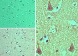 CENTD1 Antibody, Novus Biologicals:Antibodies:Primary Antibodies