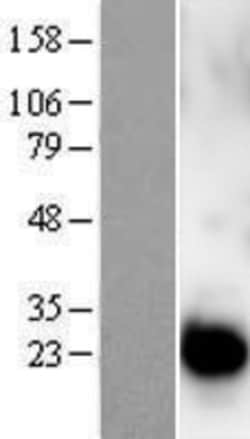 Novus Biologicals&trade;&nbsp;Centrin 1 Overexpression Lysate