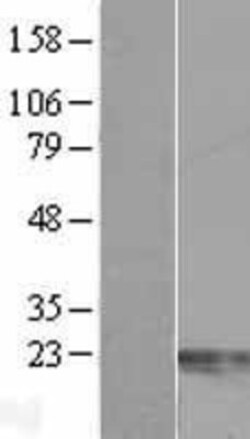 Novus Biologicals&trade;&nbsp;Centrin 2 Overexpression Lysate